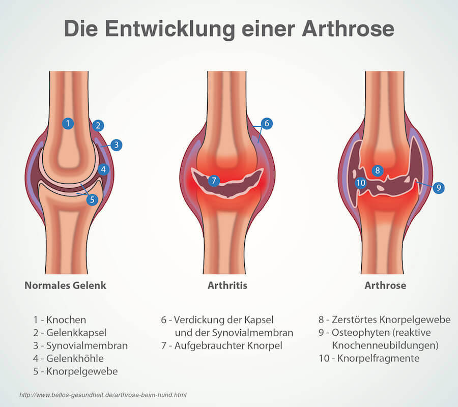 Entwicklung einer Arthrose